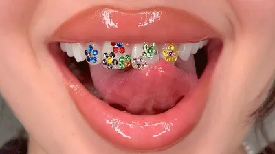 woman showing teeth jewellery